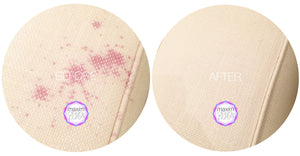 Fabric & Upholstery Spot Cleaner